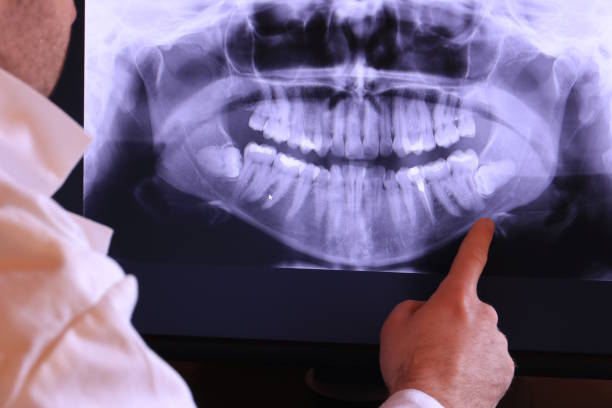Best Urgent Dental Care for Toothache in Yaeyville, NC
