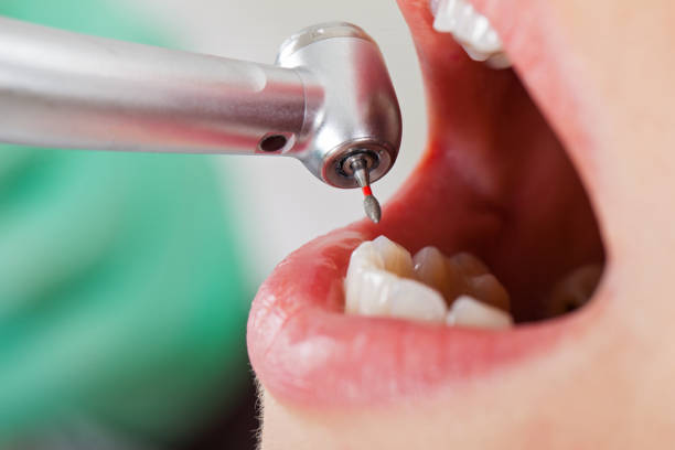 Best Broken or Cracked Tooth Emergency Dentist in Yaeyville, NC